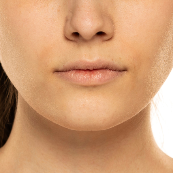 dull skin care