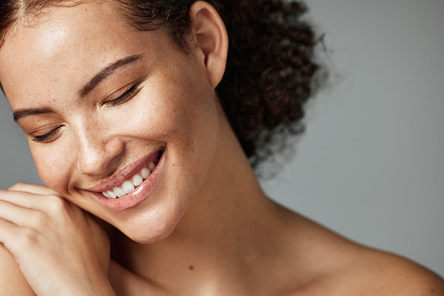 hyperpigmentation